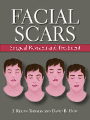 cover image of Facial Scars